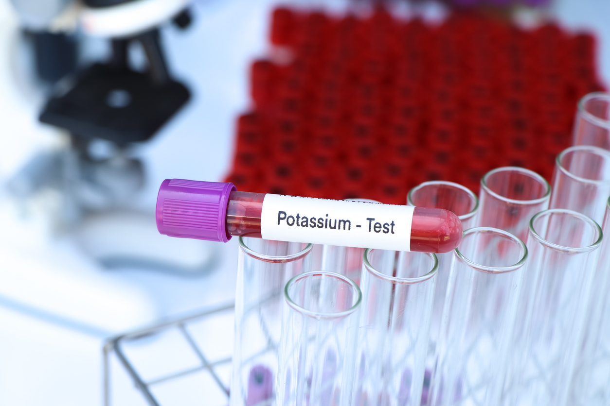 deficienta de poatasiu semne