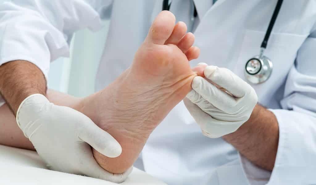 persoana la un consult la doctor cu u veruca in talpa