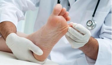 persoana la un consult la doctor cu u veruca in talpa